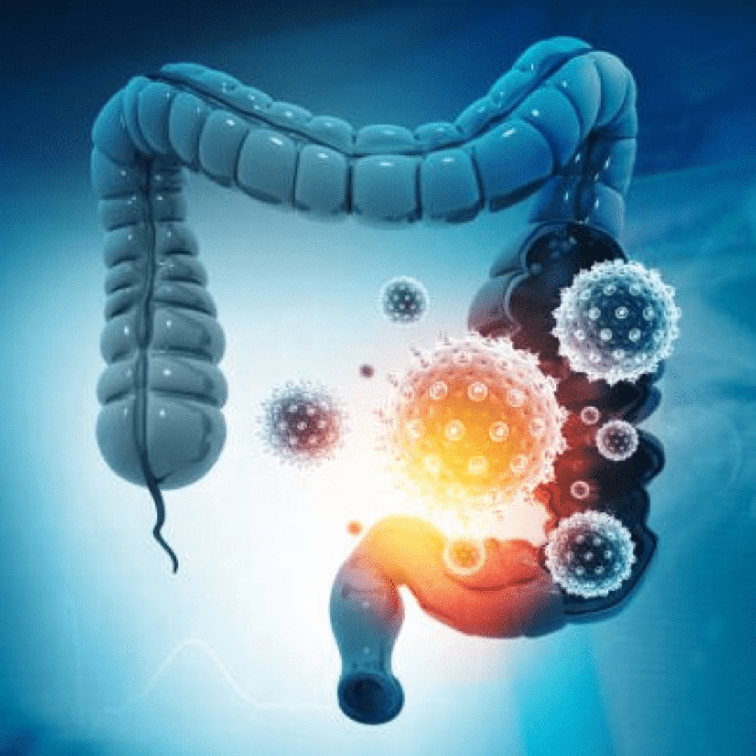 Gut microbes and immunity - Gutbasket